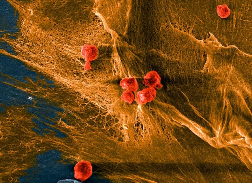 コラーゲンの繊維状ドメイン（黄色）に細胞（赤色）を播種した、研究チームのバイオハイブリッド複合体の顕微鏡写真。出典：コーネル大学