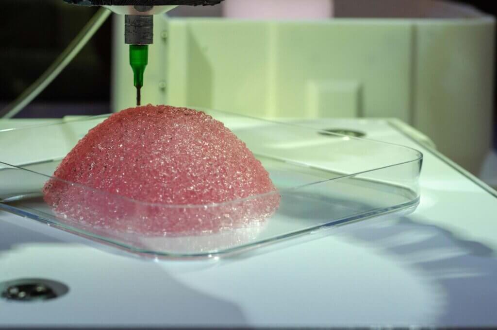 バイオ3Dプリンティングにより形成された乳房インプラント用組織　出典：Healshape社