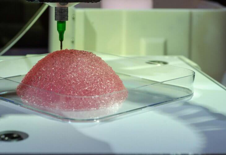 バイオ3Dプリンティングにより形成された乳房インプラント用組織　出典：Healshape社