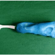 3Dプリンターでつくられた歯ブラシグリップ　出典：Cureus