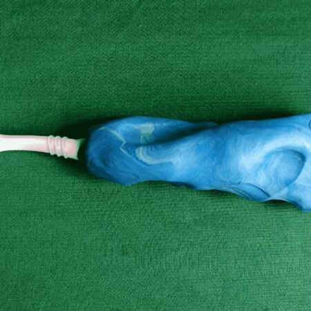 3Dプリンターでつくられた歯ブラシグリップ　出典：Cureus