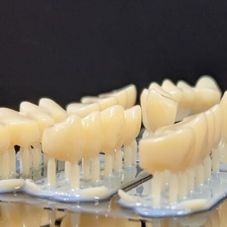 3Dプリンターでデジタルコピーされた歯（ひとり分）出典：お守り入れ歯社
