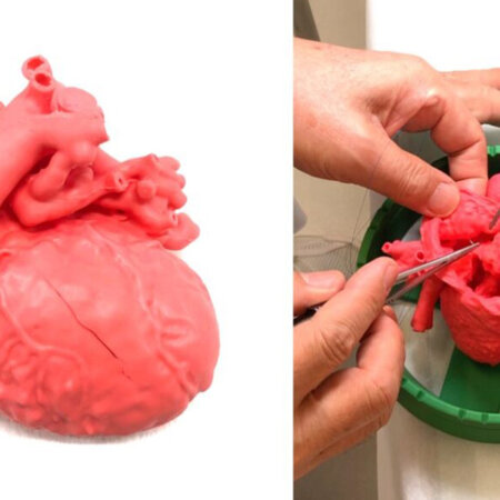 医療機器承認（クラスⅡ） を取得した「軟質実物大3D心臓モデル」
