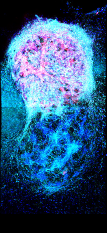 マウスに移植された3Dプリント神経細胞は蛍光マーカーで標識されている（画像では青と赤）