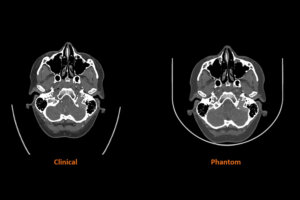 コンピューター断層撮影（CT）画像用の医療用画像ファントム