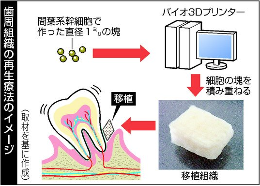 歯周組織の再生療法のイメージ図