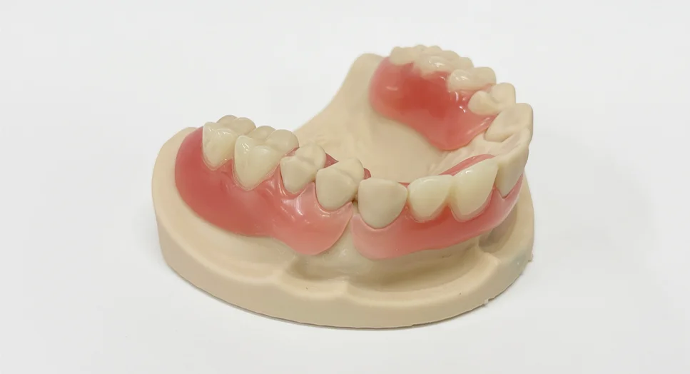 デジタルで作成した三和デンタルのパーシャルデンチャー（部分入れ歯）である「スマイルLivion」の実物（出典：三和デンタル）