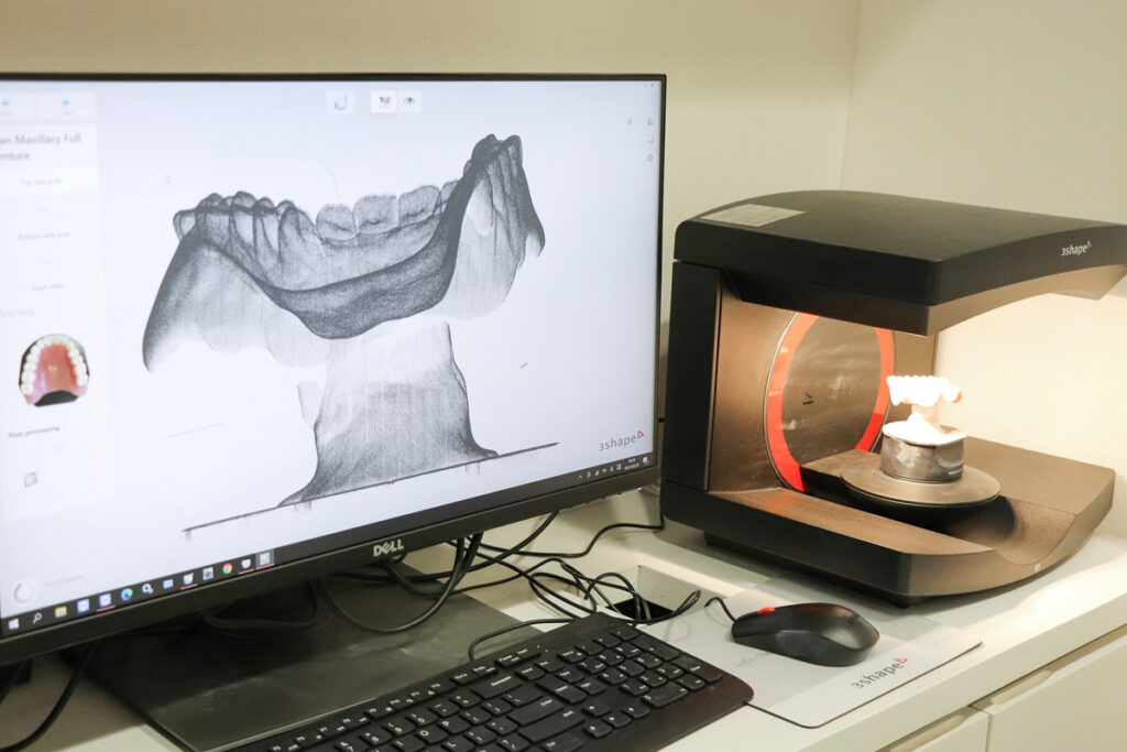 入れ歯データスキャンの様子（出典：お守り入れ歯）