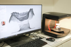 入れ歯データスキャンの様子（出典：お守り入れ歯）