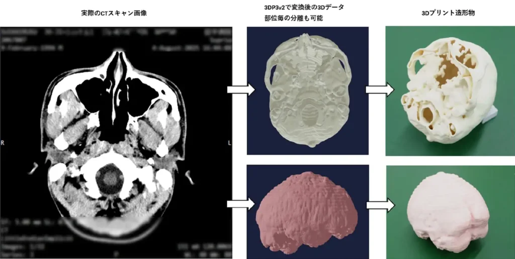 CTスキャンデータから3Dプリントまでのワークフロー例（出典：ミマキエンジニアリング）