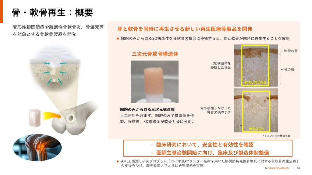 【改定新版】　骨再生のテクノロジー　/ 骨再生の概念と臨床応用 骨再生のテクノロジー<br>－骨再生の概念と臨床応用－ | ゼニス出版