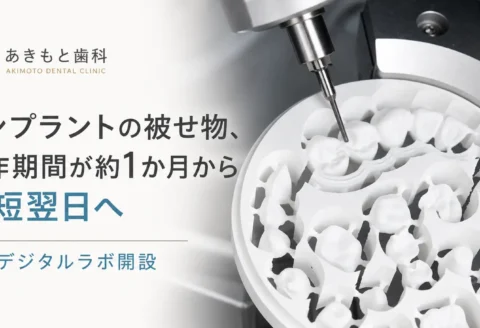 出典：あきもと歯科