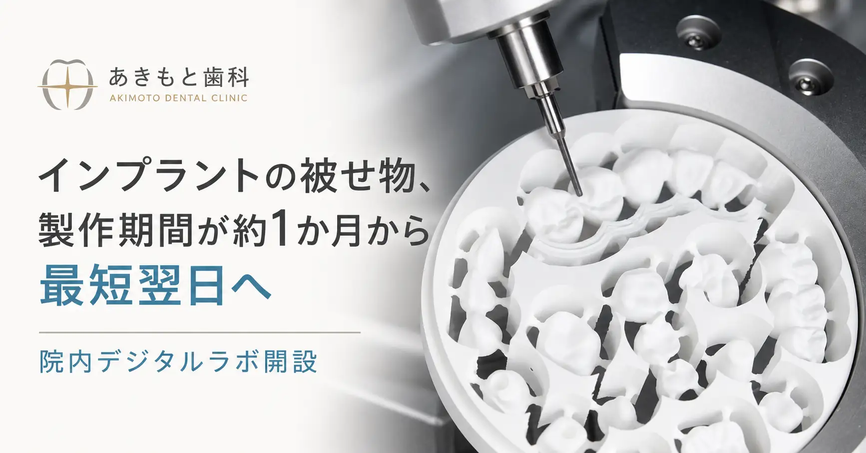 出典：あきもと歯科